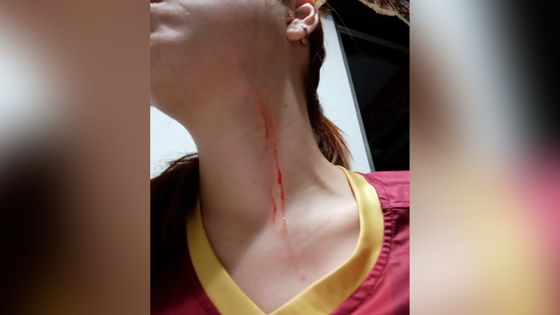 “Fue la sentencia a un infierno que jamás pensé vivir”: el relato de una mujer víctima de un atraco en Ibagué “Fue la sentencia a un infierno que jamás pensé vivir”: el relato de una mujer víctima de un atraco en Ibagué