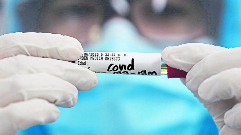 Variante Delta de COVID-19 fue detectada en cuatro personas en Bogotá Variante Delta de COVID-19 fue detectada en cuatro personas en Bogotá