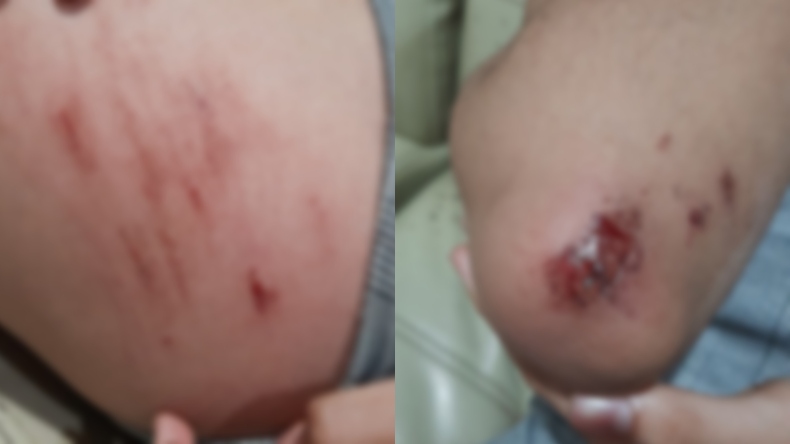 Tres menores de edad casi son raptadas en vehículo de transporte público en Ibagué Tres menores de edad casi son raptadas en vehículo de transporte público en Ibagué