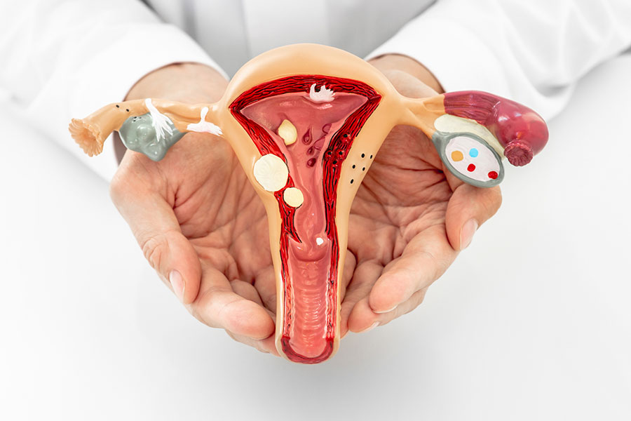Estos son los cinco tipos de cáncer ginecológico que más afectan a las mujeres en Colombia Estos son los cinco tipos de cáncer ginecológico que más afectan a las mujeres en Colombia