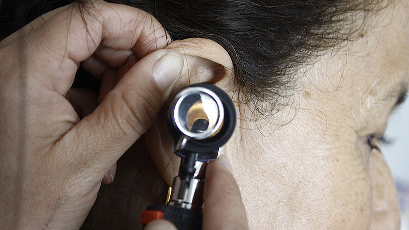 Investigaciones de la Universidad Nacional revelaron que pacientes con tinnitus podrían tener una solución Investigaciones de la Universidad Nacional revelaron que pacientes con tinnitus podrían tener una solución