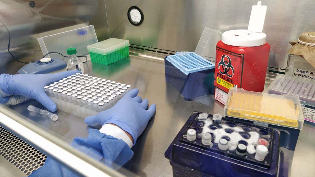 Gobierno anunció que más de 15.000 reactivos para las pruebas del COVID-19 serán enviados al Tolima Gobierno anunció que más de 15.000 reactivos para las pruebas del COVID-19 serán enviados al Tolima