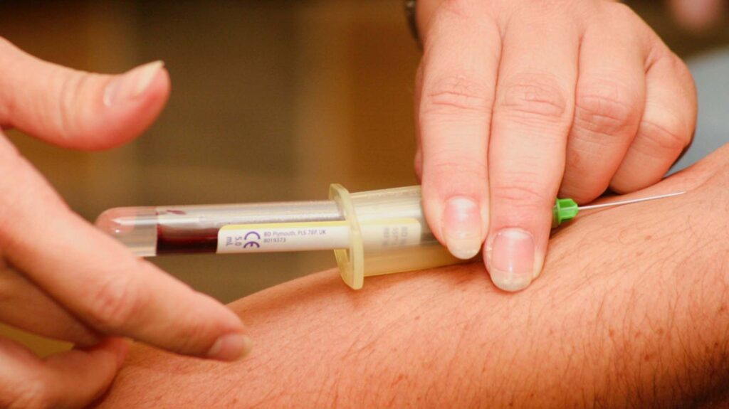 Estos son los cuidados especiales que deberán tener las personas con hemofilia durante la pandemia del COVID-19 Estos son los cuidados especiales que deberán tener las personas con hemofilia durante la pandemia del COVID-19
