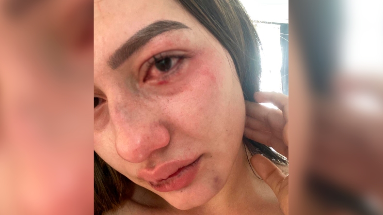 «Me dijo que me iba apuñalar y se dirigió a la cocina a buscar un cuchillo»: joven denuncia agresiones por parte de su exnovio «Me dijo que me iba apuñalar y se dirigió a la cocina a buscar un cuchillo»: joven denuncia agresiones por parte de su exnovio