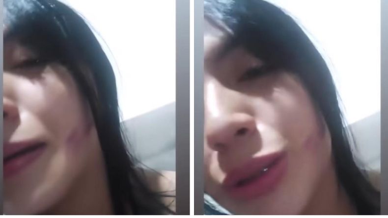 Joven denunció agresión física de su expareja y ahora teme por su vida y la de su hija Joven denunció agresión física de su expareja y ahora teme por su vida y la de su hija