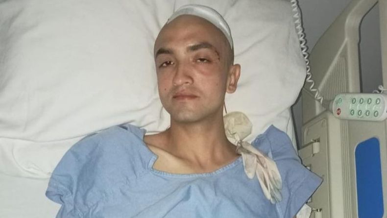 Joven sufrió fractura de cráneo por fuerte golpiza que al parecer recibió dentro de bar en Ibagué Joven sufrió fractura de cráneo por fuerte golpiza que al parecer recibió dentro de bar en Ibagué