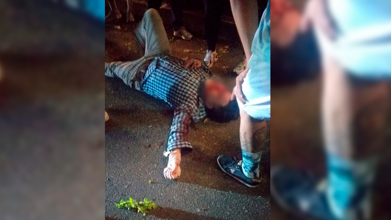 Motociclista que atropelló a joven que escapaba de un robo en Ibagué se encuentra en delicado estado de salud Motociclista que atropelló a joven que escapaba de un robo en Ibagué se encuentra en delicado estado de salud