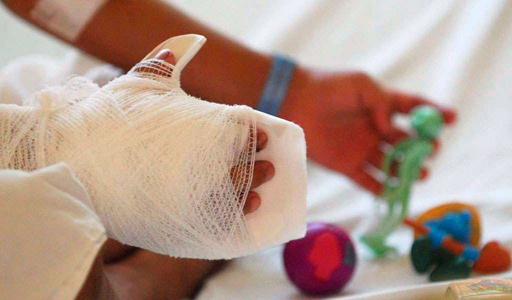 «Hasta que a uno no le pasa, no aprende»: madre de niño que resultó quemado con pólvora en el Tolima «Hasta que a uno no le pasa, no aprende»: madre de niño que resultó quemado con pólvora en el Tolima