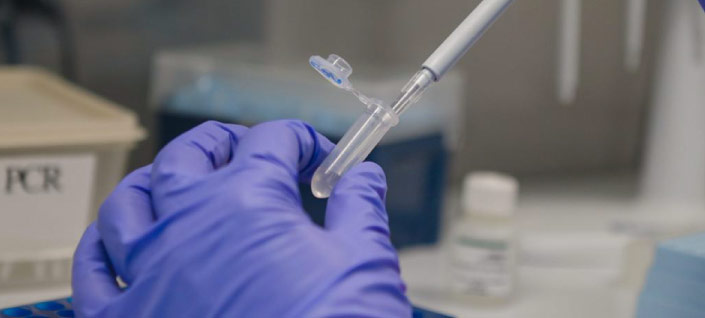 Pruebas rápidas para VIH, sífilis, hepatitis B y C serán realizadas fuera de laboratorios: MinSalud Pruebas rápidas para VIH, sífilis, hepatitis B y C serán realizadas fuera de laboratorios: MinSalud