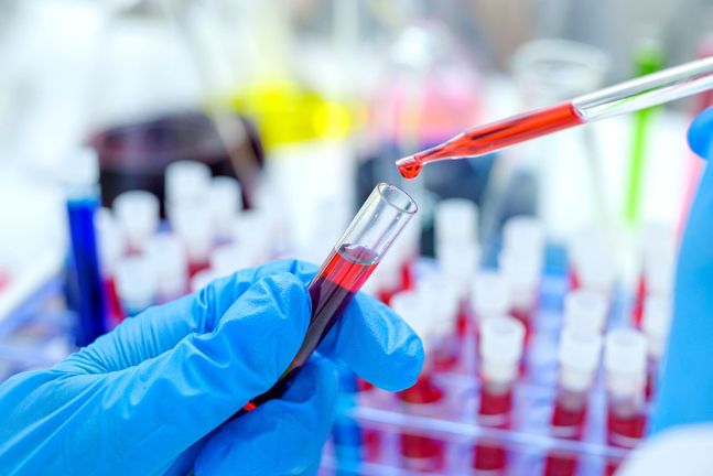 Siguen en aumento los casos de VIH positivo en Ibagué Siguen en aumento los casos de VIH positivo en Ibagué