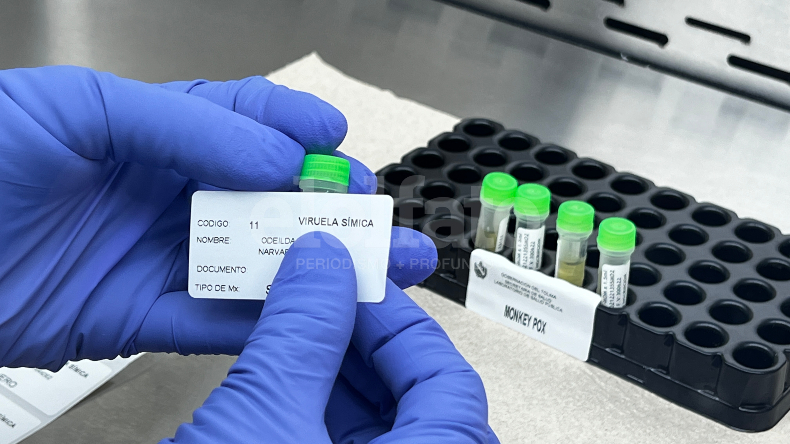 Le contamos cómo procesan en Ibagué las pruebas que detectan viruela del mono Le contamos cómo procesan en Ibagué las pruebas que detectan viruela del mono