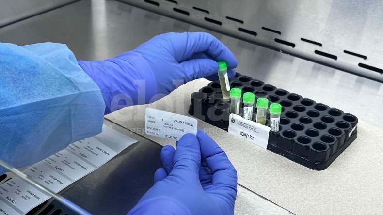 En Ibagué ya se registran 14 casos de viruela símica En Ibagué ya se registran 14 casos de viruela símica