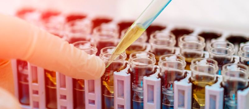 Descartan 140 casos sospechosos de coronavirus en Ibagué y 63 continúan en estudio Descartan 140 casos sospechosos de coronavirus en Ibagué y 63 continúan en estudio