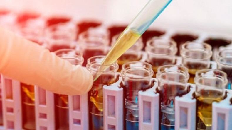 EPS deberán practicar pruebas rápidas para COVID-19: Minsalud EPS deberán practicar pruebas rápidas para COVID-19: Minsalud