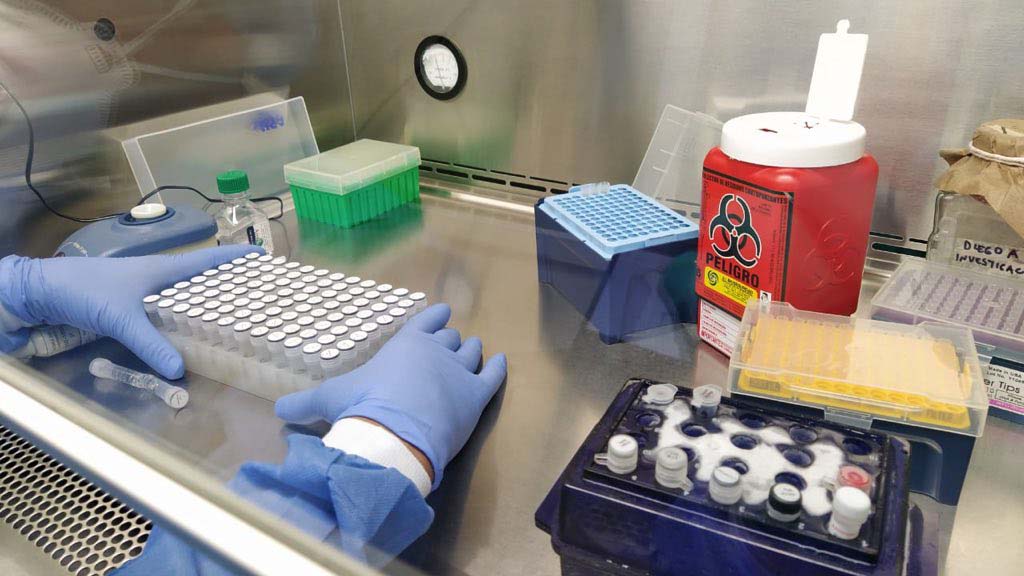 INS espera superar el millón de pruebas rápidas de COVID-19 en los próximos tres meses INS espera superar el millón de pruebas rápidas de COVID-19 en los próximos tres meses