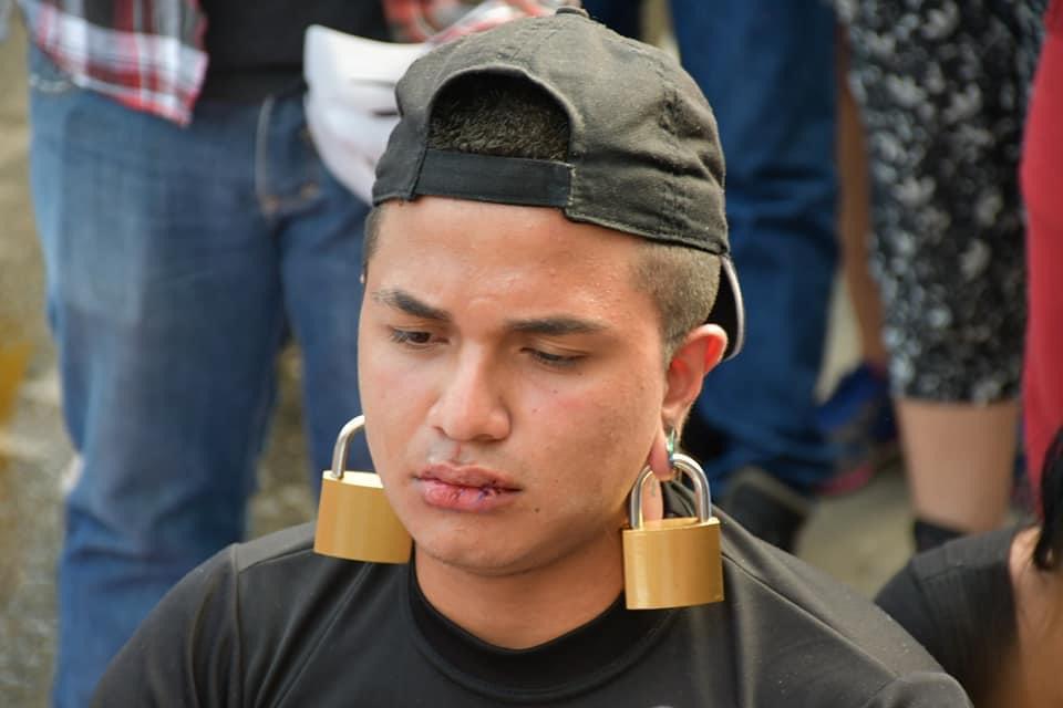 Joven inició huelga de hambre y se cosió los labios en Ibagué Joven inició huelga de hambre y se cosió los labios en Ibagué