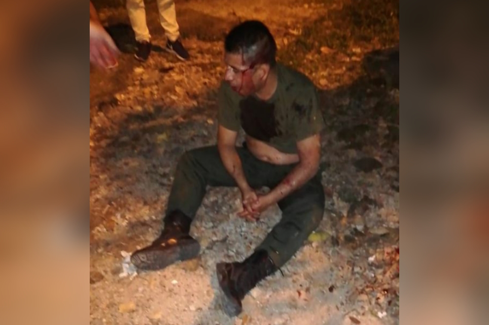 Policía en aparente estado de embriaguez provocó choque múltiple en Ibagué Policía en aparente estado de embriaguez provocó choque múltiple en Ibagué