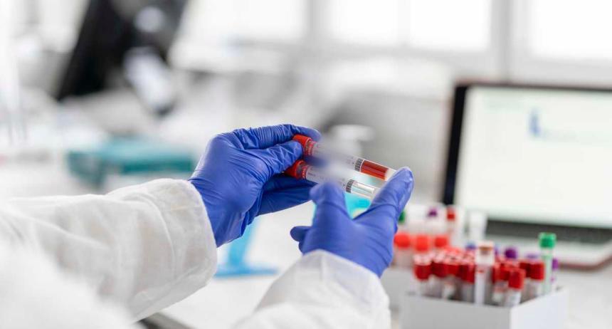 Un total de 184 personas han sido diagnosticadas con VIH y Sida en Ibagué Un total de 184 personas han sido diagnosticadas con VIH y Sida en Ibagué