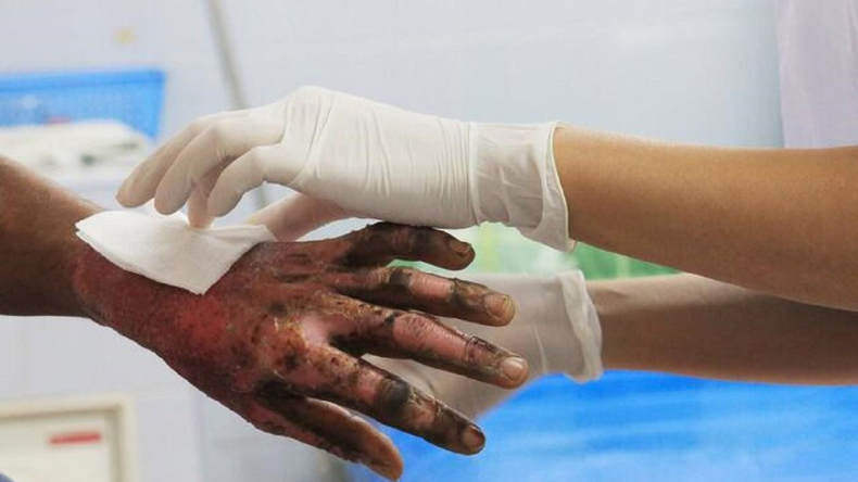 Noche de Velitas en Ibagué dejó dos lesionados por pólvora Noche de Velitas en Ibagué dejó dos lesionados por pólvora