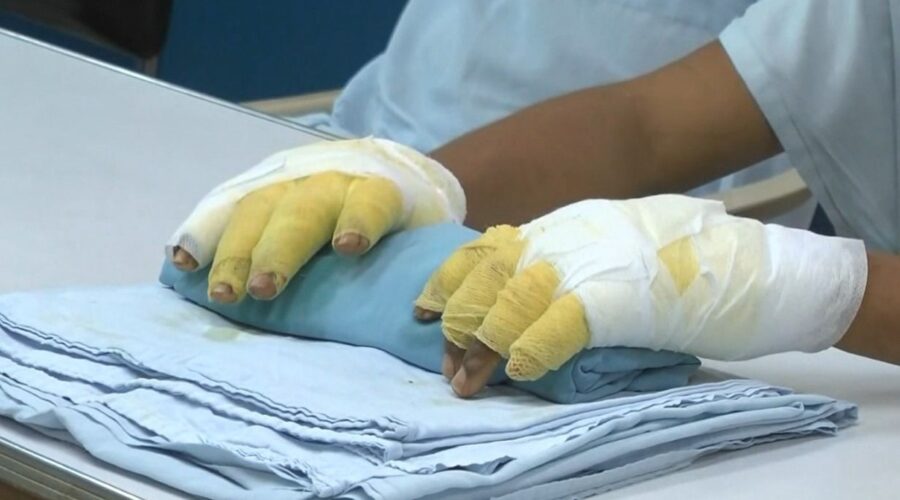 Temporada decembrina dejó 45 personas lesionadas con pólvora en el Tolima Temporada decembrina dejó 45 personas lesionadas con pólvora en el Tolima