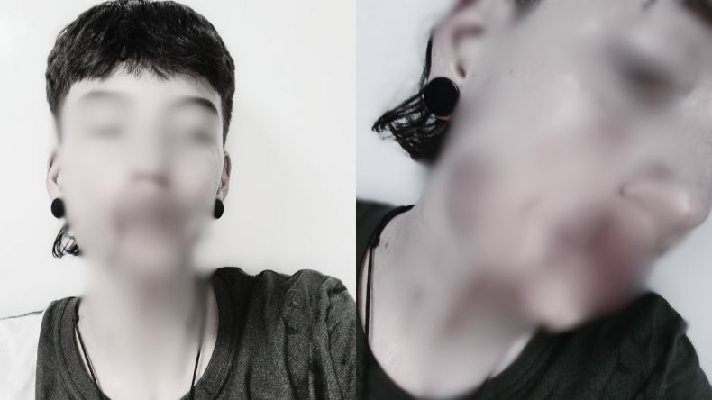 Pitbull desfiguró rostro a una joven en Ibagué: “El dueño le dio la orden de atacarme” Pitbull desfiguró rostro a una joven en Ibagué: “El dueño le dio la orden de atacarme”