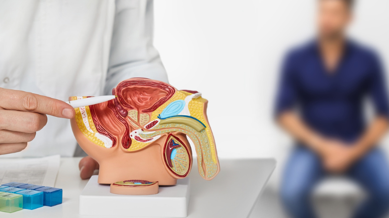Cáncer de próstata en Colombia: más de 65.000 casos y un diagnóstico aún tardío
