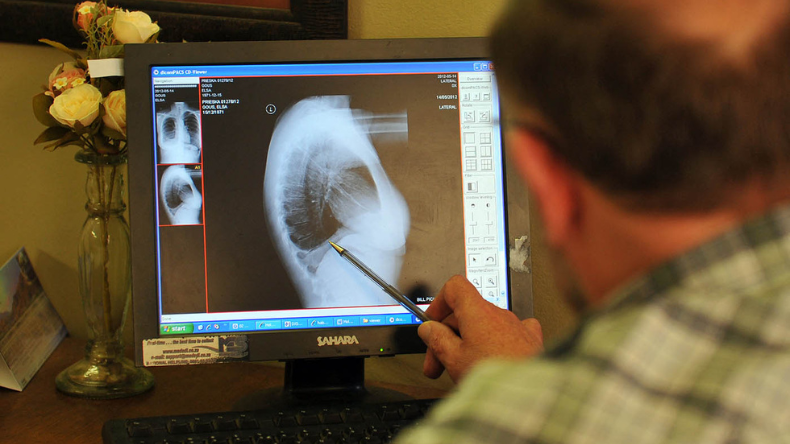 Más de 1.500 muertos en Colombia por exposición al asbesto Más de 1.500 muertos en Colombia por exposición al asbesto