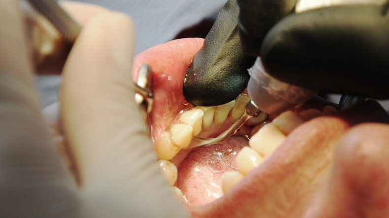 Descubren la bacteria que más destruye las encías de los colombianos Descubren la bacteria que más destruye las encías de los colombianos