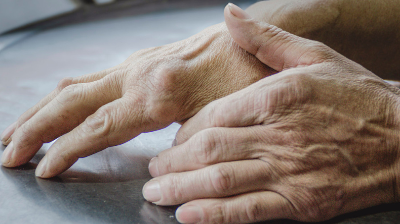 Cerca de 148 mil personas viven con artritis reumatoide en Colombia