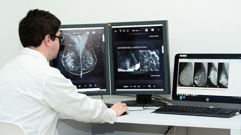 Descubren genes que predicen la eficacia de la quimioterapia en cáncer de mama Descubren genes que predicen la eficacia de la quimioterapia en cáncer de mama