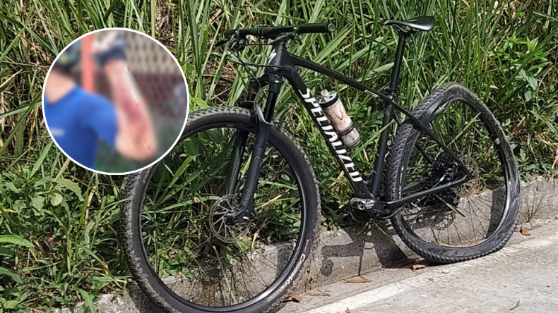 Dos ciclistas fueron atacados con machete en zona rural de Ibagué Dos ciclistas fueron atacados con machete en zona rural de Ibagué