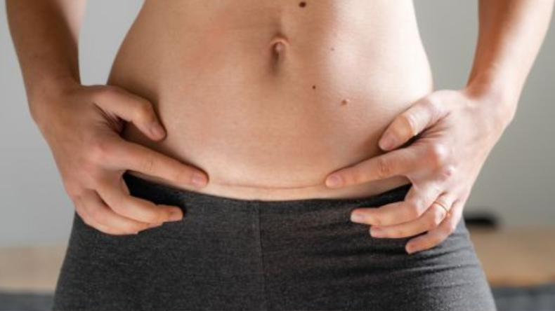 Mujeres podrán solicitar reversión de ligadura de trompas tras fallo de la Corte Mujeres podrán solicitar reversión de ligadura de trompas tras fallo de la Corte